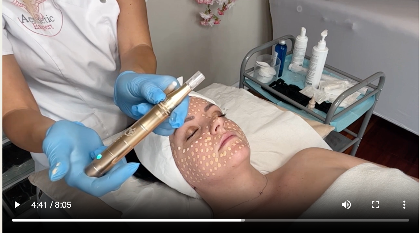 Formation Microneedling et BB Glow en ligne
