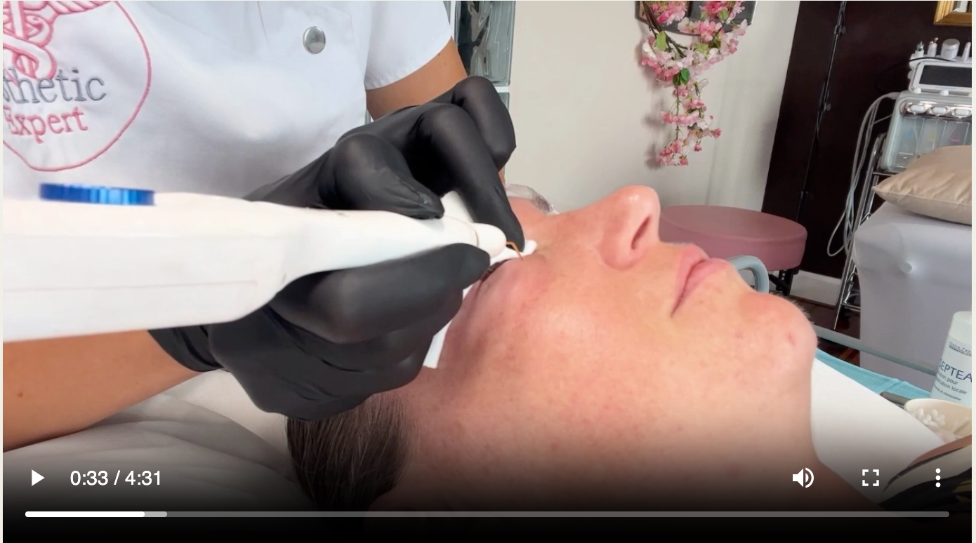 Formation Plasma Pen en ligne
